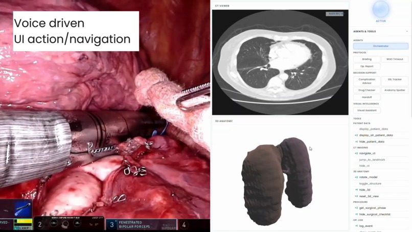 ORION - Operating Room Intelligent Orchestration Node – screenshot 3
