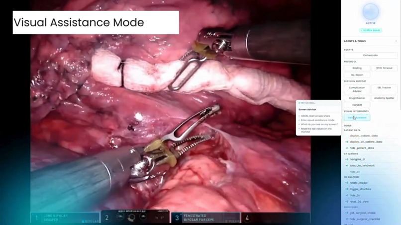 ORION - Operating Room Intelligent Orchestration Node – screenshot 6