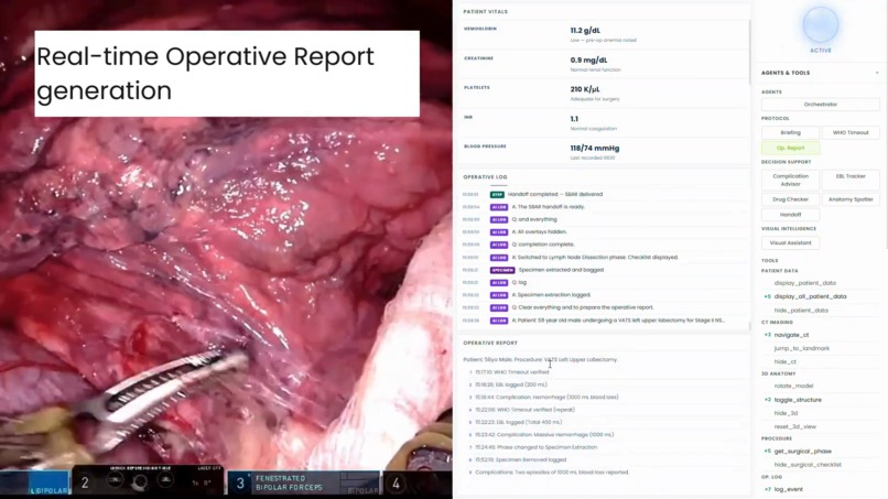 ORION - Operating Room Intelligent Orchestration Node – screenshot 4