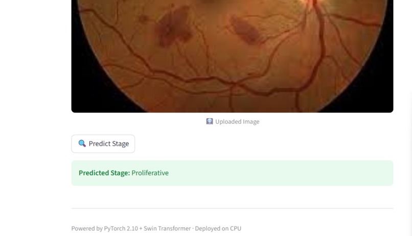Diabetic Retinopathy Stage Prediction – screenshot 2