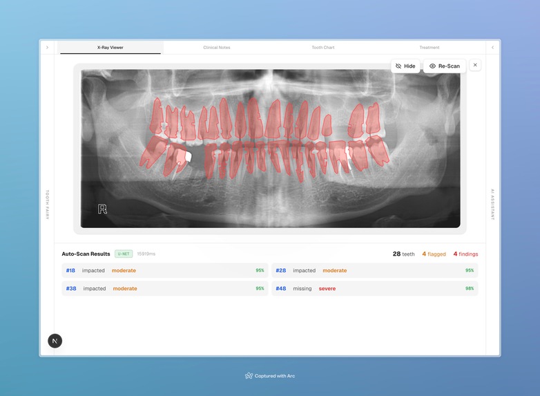 toothfairy – screenshot 3