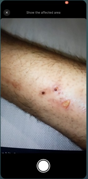 MedLens AI – screenshot 4