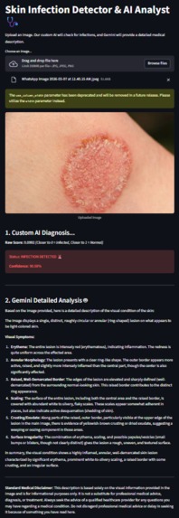 AI_SKIN_DOCTOR – screenshot 5