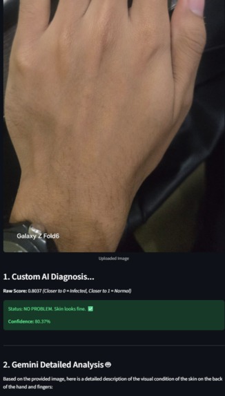 AI_SKIN_DOCTOR – screenshot 3