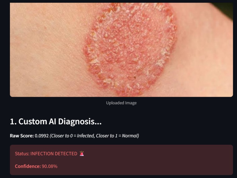 AI_SKIN_DOCTOR – screenshot 6