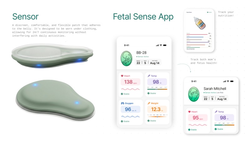 Fetal Sense – screenshot 2