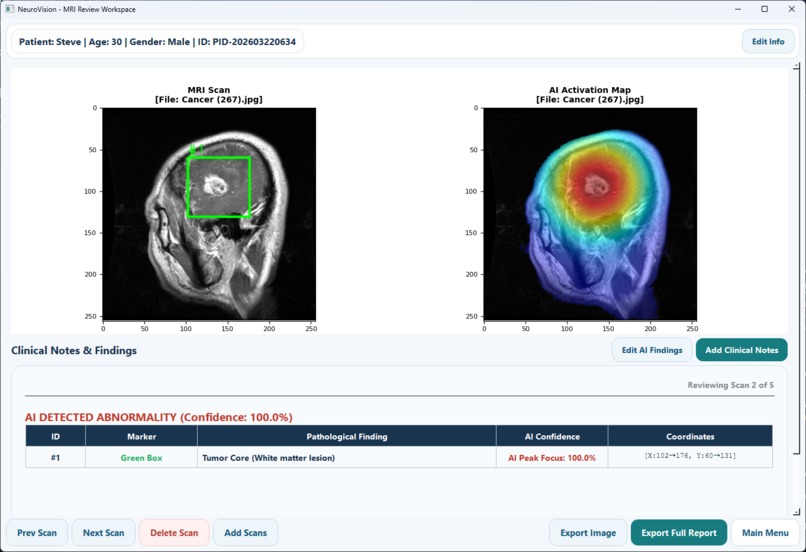 NeuroVision – screenshot 2