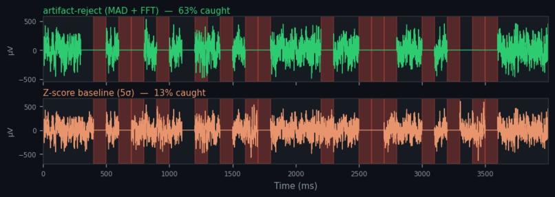Artifact Reject – screenshot 2