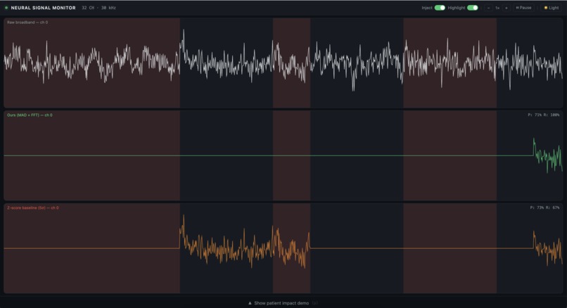 Artifact Reject – screenshot 3