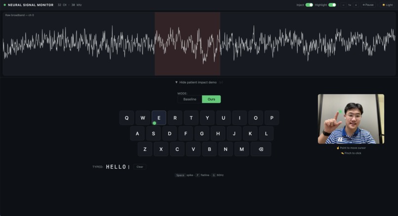 Artifact Reject – screenshot 4