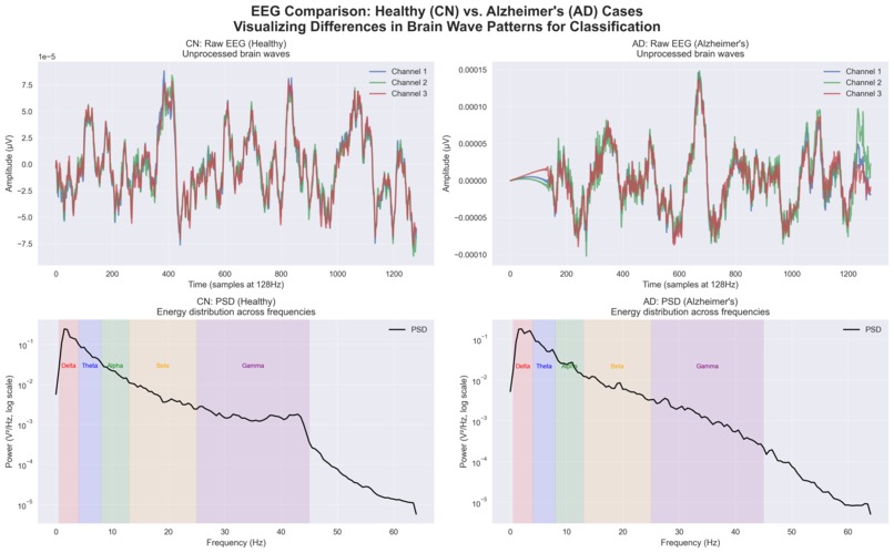 Alzheimer's Disease Detection Support Vector Machine (EEG) – screenshot 1