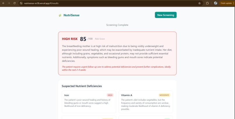 NutriSense | AI Malnutrition Risk Screener – screenshot 3