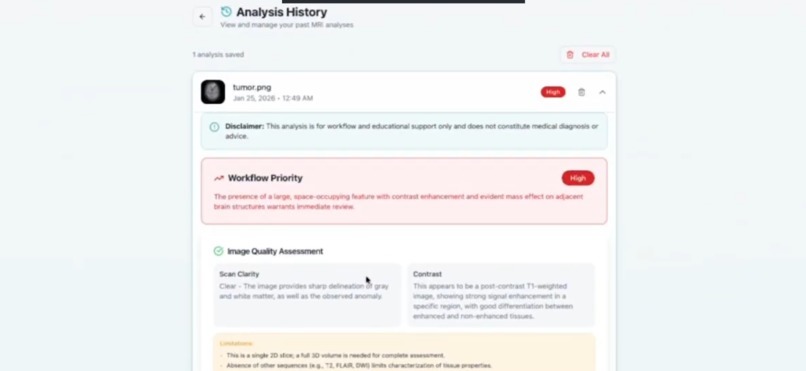 NeuroScan AI – screenshot 8