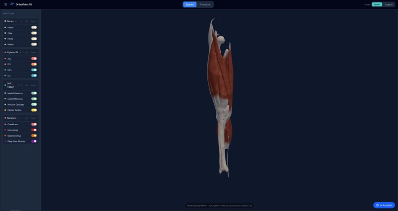 OrthoVision – screenshot 2