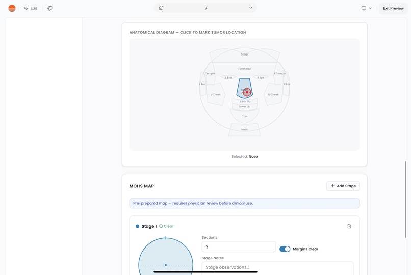 MohsEdge – screenshot 1