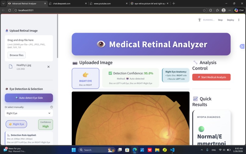 AI-Based Phone integrated Retinal Analysis for Myopia  – screenshot 1