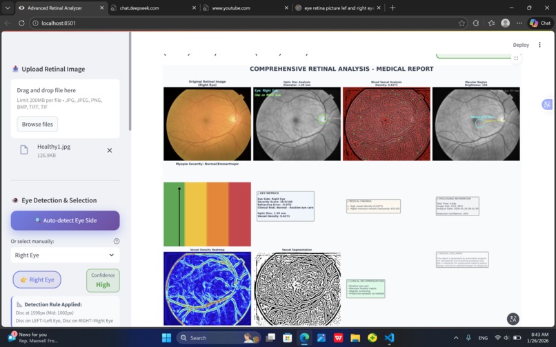 AI-Based Phone integrated Retinal Analysis for Myopia  – screenshot 2