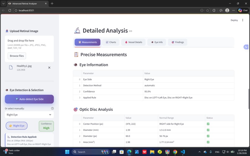 AI-Based Phone integrated Retinal Analysis for Myopia  – screenshot 3