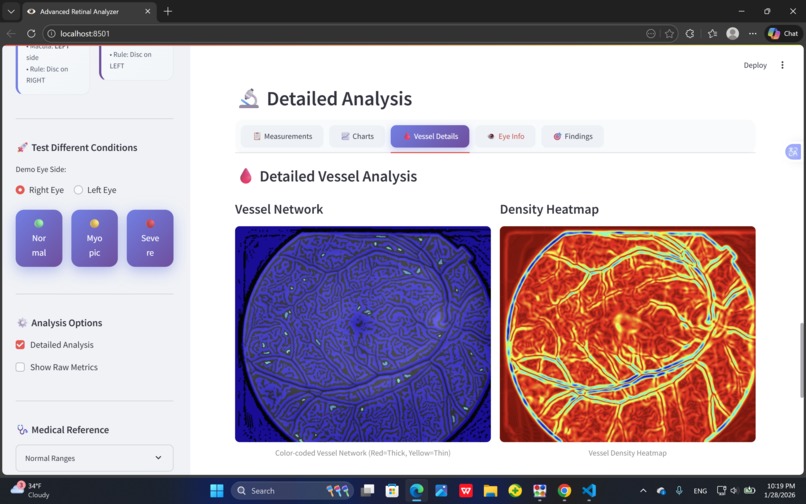 AI-Based Phone integrated Retinal Analysis for Myopia  – screenshot 5