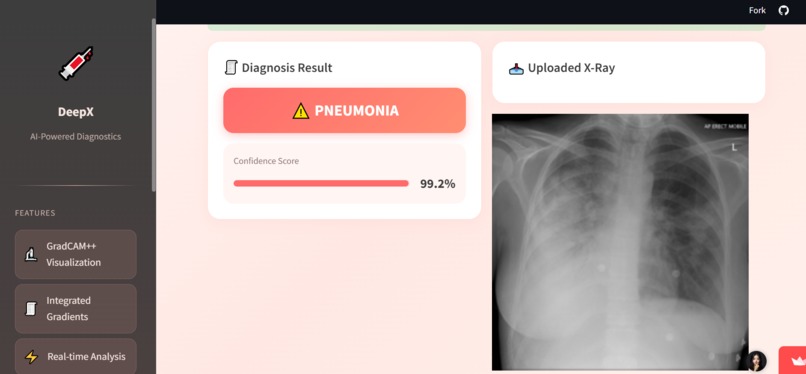 DeepX-ChestXRay – screenshot 2