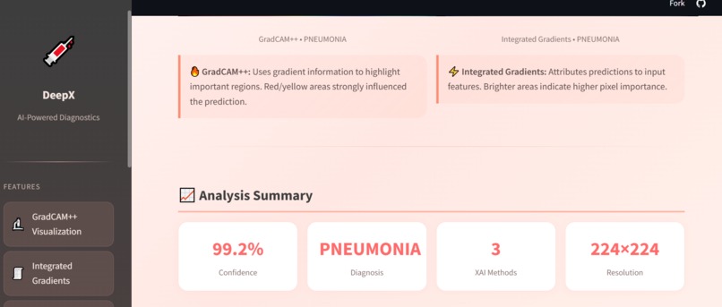 DeepX-ChestXRay – screenshot 3