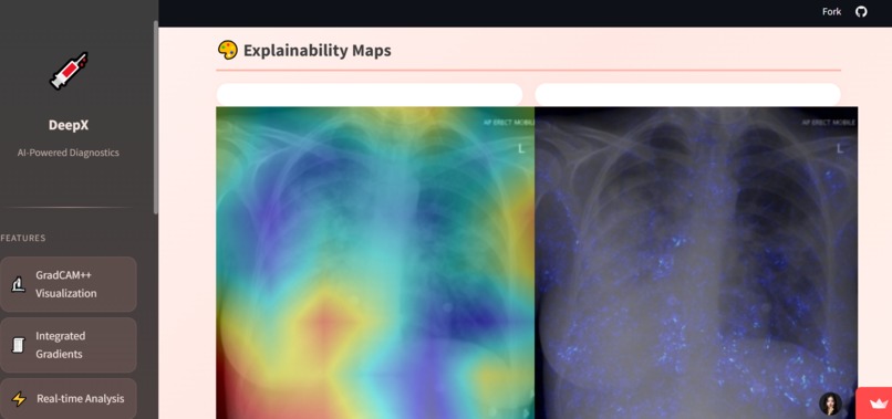 DeepX-ChestXRay – screenshot 4