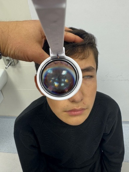 Gemini AI for Early Myopia Screening – screenshot 9