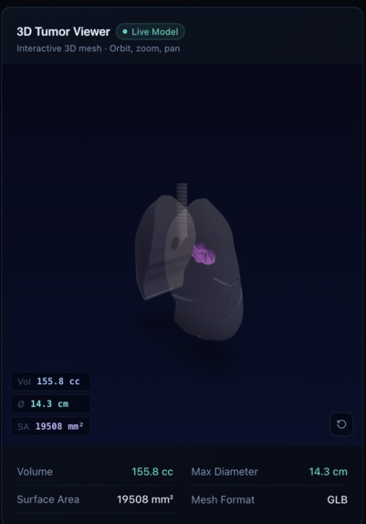 LungIQ – screenshot 4