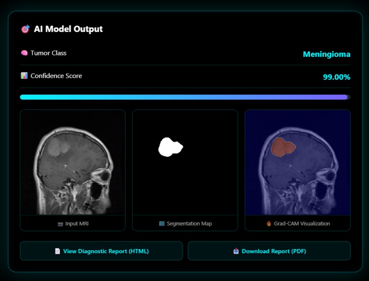 Advanced NN for Brain Tumor Det. & Classification Using MRI – screenshot 5