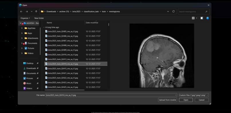 Advanced NN for Brain Tumor Det. & Classification Using MRI – screenshot 2