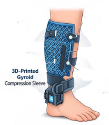 Adaptive 3D Compression Systems for Leg Fluid Retention Care – screenshot 1