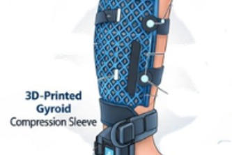Adaptive 3D Compression Systems for Leg Fluid Retention Care