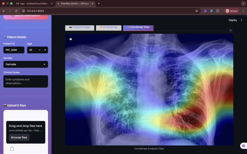 Xraynet+ – screenshot 3
