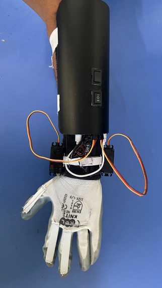 Smart Wrist-Hand Orthosis for Functional Independence – screenshot 1