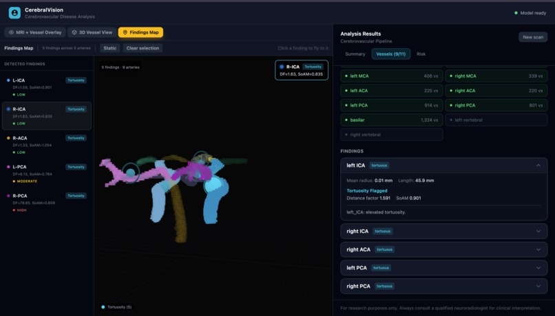 VascuSense - Cerebrovascular arterial blood vessel analysis – screenshot 5