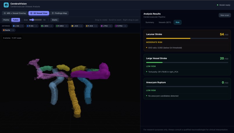 VascuSense - Cerebrovascular arterial blood vessel analysis – screenshot 4