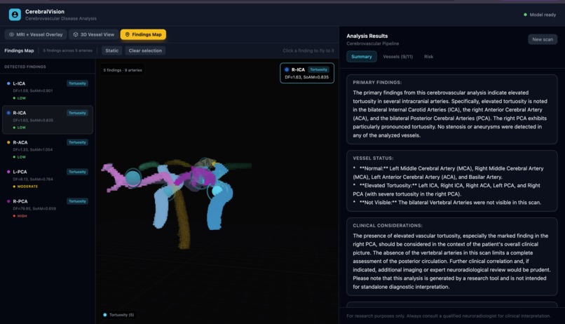 VascuSense - Cerebrovascular arterial blood vessel analysis – screenshot 1