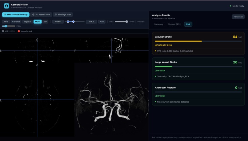 VascuSense - Cerebrovascular arterial blood vessel analysis – screenshot 3