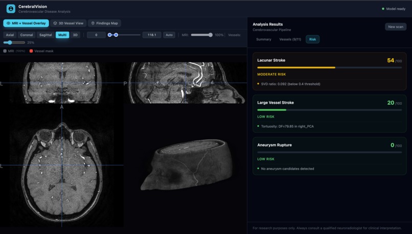 VascuSense - Cerebrovascular arterial blood vessel analysis – screenshot 2