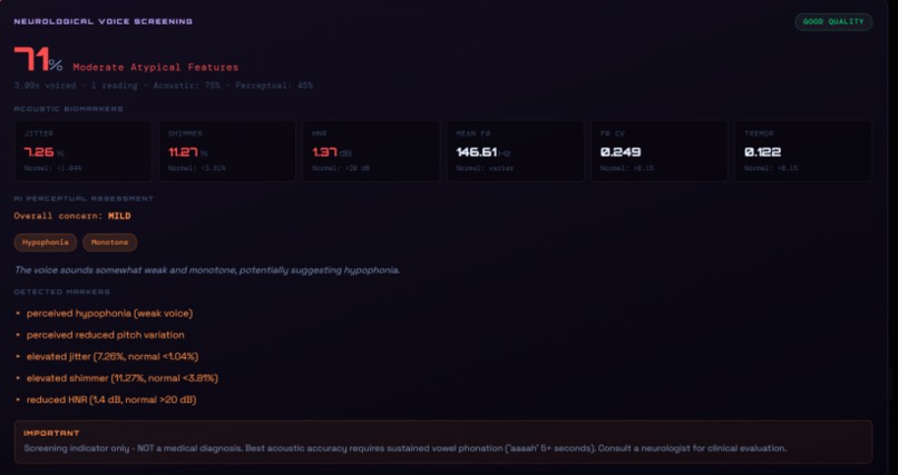 VoicePulse – screenshot 2