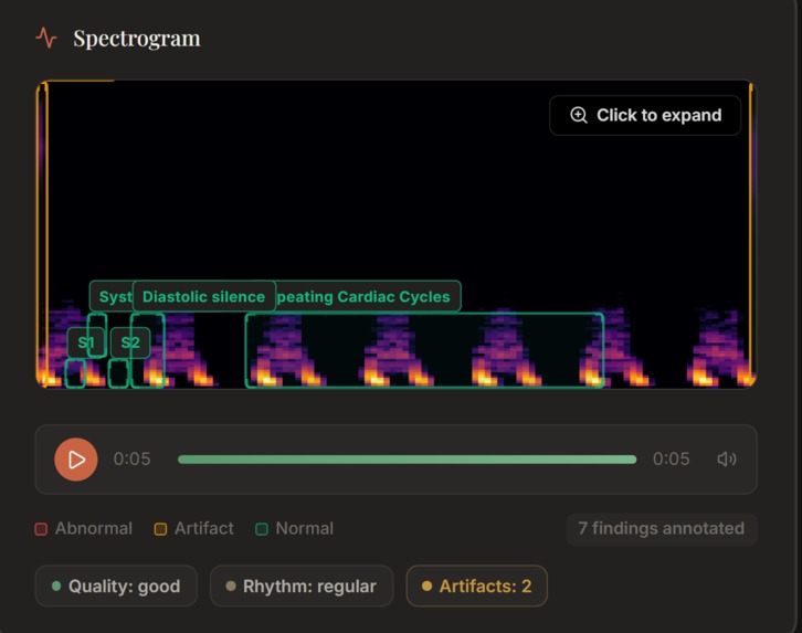 Auscult AI – screenshot 2