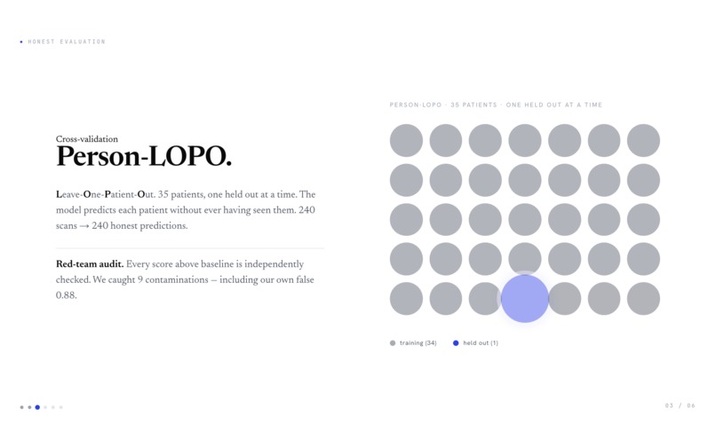 Lacrima – screenshot 5