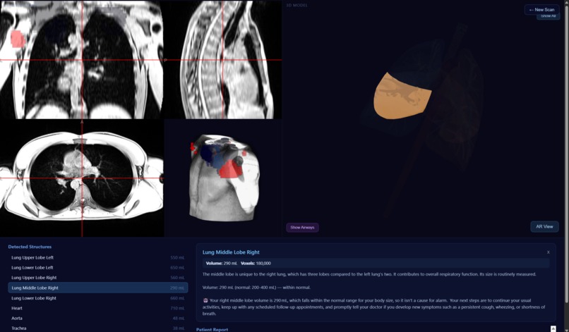 Graphfol – screenshot 5