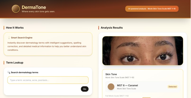 DermaTone – screenshot 1
