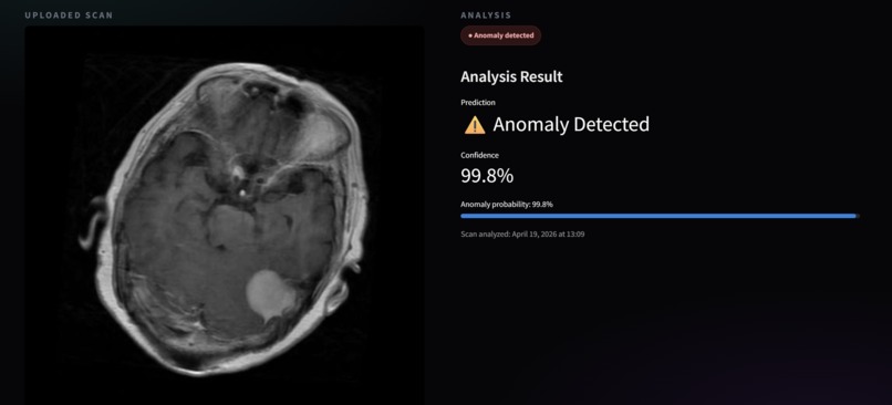 Synapse - AI-assisted anomaly detection & Support System – screenshot 3