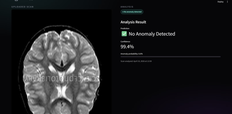 Synapse - AI-assisted anomaly detection & Support System – screenshot 4