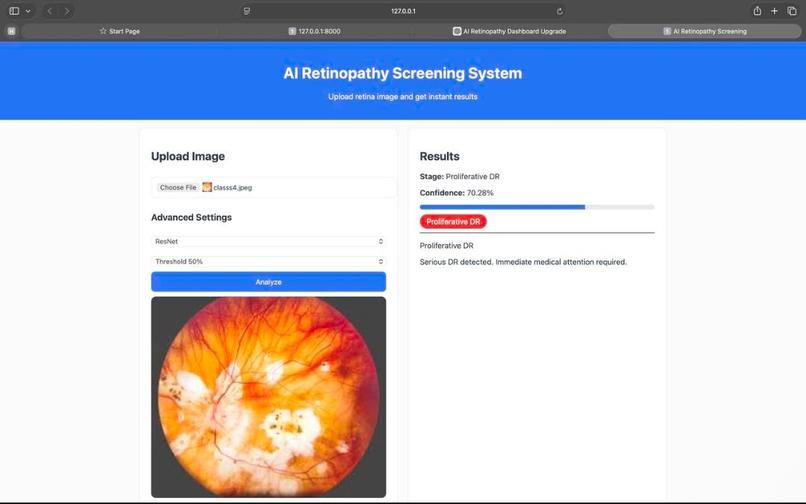 Early-Stage Diabetic Retinopathy Prediction  – screenshot 1