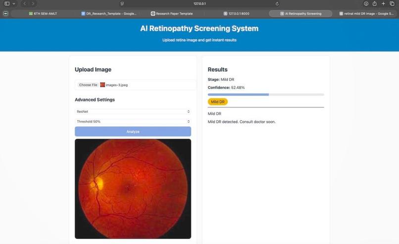 Early-Stage Diabetic Retinopathy Prediction  – screenshot 2