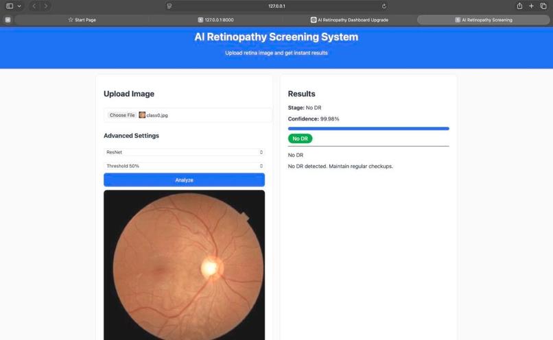 Early-Stage Diabetic Retinopathy Prediction  – screenshot 3