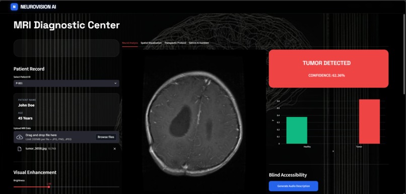 NeuroVision AI – screenshot 2